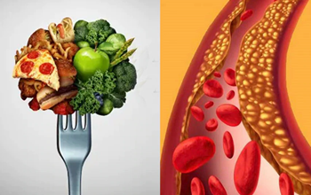 Good Cholesterol : हमारे शरीर को क्यों होती है गुड कोलेस्ट्रॉल की जरूरत? जानिए इसे बढ़ाने के तरीके...