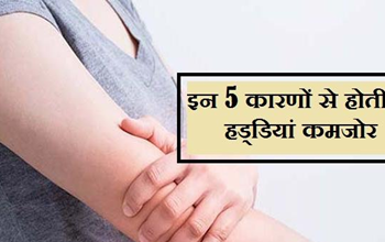 Tips For Healthy Bones: भूल से भी न करें ये 5 गलतियां, हड्डियां हो जाती हैं कमजोर; आज से ही छोड़ दें ये काम...