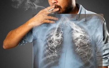 अचानक सिगरेट छोड़ना लंग कैंसर के संकेत! शरीर में 5 बदलाव हो सकते हैं इस घातक बीमारी के लक्षण, तत्काल करें निदान...