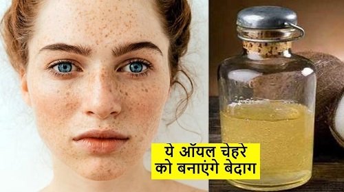 Pimples और Acne को जड़ से मिला देंगे ये Essential Oils, आइने में दिखेगा बेदाग चेहरा....