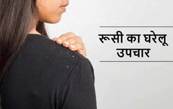 Dandruff Solution: बालों से झड़ते डैंड्रफ ने कर दिया है शर्मिंदा? बस पानी में मिलाकर लगाएं ये चीज, दूर होगी समस्या