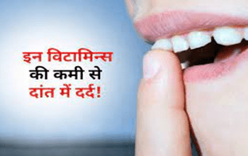 Dental Care: दांत में दर्द, मुंह की बदबू से हो चुके हैं परेशान, कहीं शरीर में इन 3 Vitamins की कमी तो नहीं...