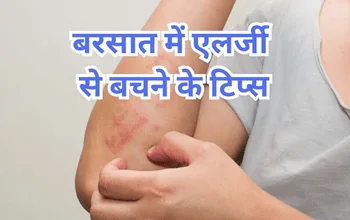 Monsoon Allergy Prevention Tips: मानसून में एलर्जी से बढ़ गई है परेशानी? आजमा लें ये असरदार घरेलू नुस्खे, फट से मिल जाएगा आराम