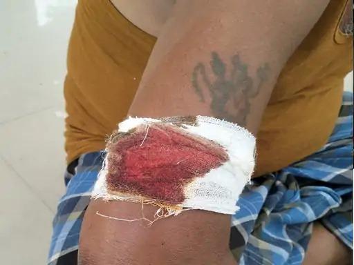 खुर्सीपार में रात भर दबंगों ने की मारपीट: कई लोगों को घायल करने के बाद कर दिया थाने का घेराव, पुलिस जांच में जुटी 5 खुर्सीपार में रात भर दबंगों ने की मारपीट: कई लोगों को घायल करने के बाद कर दिया थाने का घेराव, पुलिस जांच में जुटी