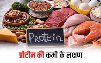 Protein Deficiency: शरीर में प्रोटीन की कमी होने पर दिखने लगते हैं ये 5 बदलाव, न करें लापरवाही...