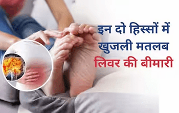 Liver Disease: त्वचा में खुजली समेत ये 6 प्रॉब्लम है लिवर में पल रही बड़ी बीमारी का संकेत, नजरअंदाज करना पड़ सकता है भारी