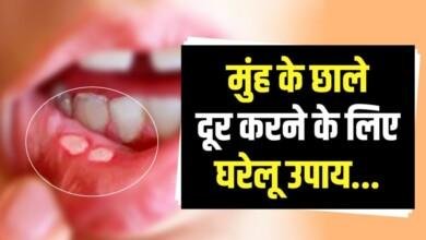 Home Remedies: मुंह के छालों से हैं परेशान? इन नुस्खों को अपनाकर पा सकते हैं छुटकारा....