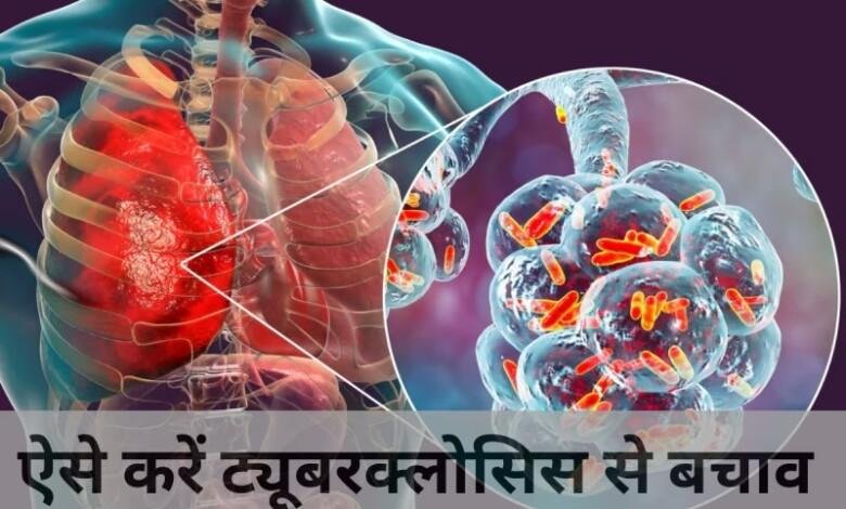 Tuberculosis Causes: टीबी की बीमारी ने तोड़ा दशकों का रिकॉर्ड, पिछले साल मिले 25 लाख मरीज; यूपी सबसे आगे...