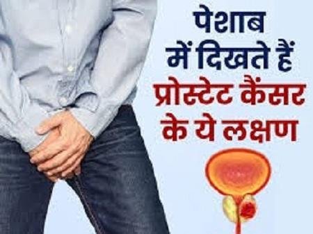 Prostate Cancer Symptoms: पेशाब करने में हो रही है परेशानी? प्रोस्टेट कैंसर के इन 5 लक्षणों को नजरअंदाज करना पड़ेगा भारी